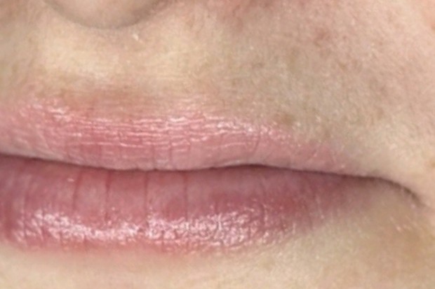 Lippen van een klant voor de lippigmentatie